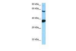 Dopamine D3R/DRD3 Rabbit anti-Human, Polyclonal, Novus Biologicals 0.1 mL | Buy Online | Novus Biologicals | Fisher Scientific